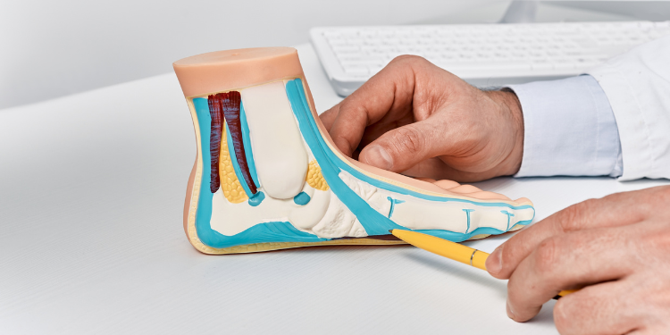 platfus, arc plantar, picior plat, simptome platfus, tratament platfus, cauze platfus, 