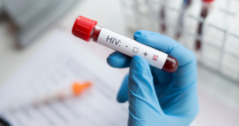 Simptomele HIV pe care bărbații ar trebui să le cunoască