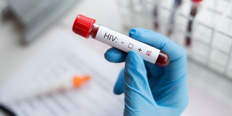 Simptomele HIV pe care bărbații ar trebui să le cunoască