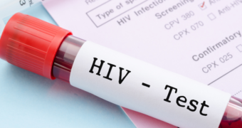 Informații importante despre virusul HIV