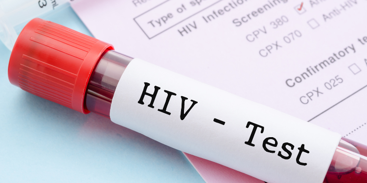 Informații importante despre virusul HIV