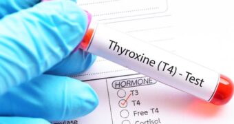 Tiroxina liberă (FT4): valori normale, semnificații clinice pentru FT4 scăzut