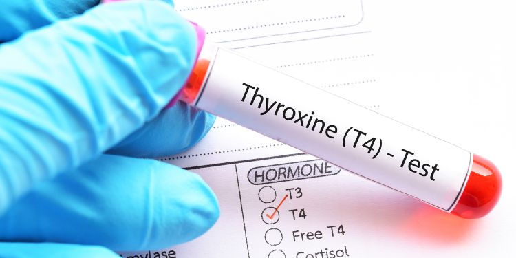 Tiroxina liberă (FT4): valori normale, semnificații clinice pentru FT4 scăzut