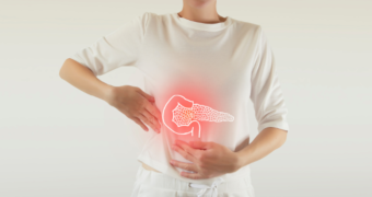 Cancer de pancreas – simptome și tratament