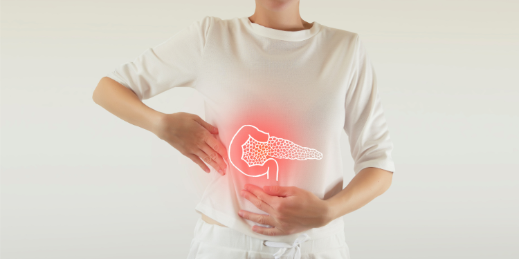 Cancer de pancreas – simptome și tratament